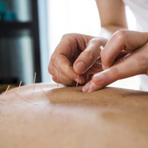 the-dymocks-building-shops-Dr-Kirk-Wilson-Acupuncture-TCM