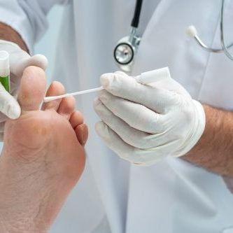 Doctor dermatologist examines the foot on the presence of athletes foot