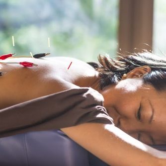 Young woman, Japanese ethnicity, at the acupuncture treatment, she has electrical stimulation in her back. She is lying  at bright window.